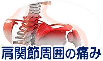 肩関節周囲の痛み
